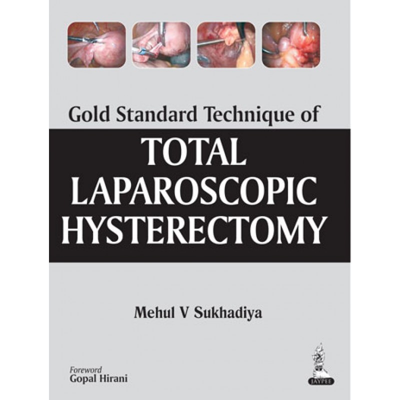 Gold Standard Technique of Total Laparoscopic Hysterectomy