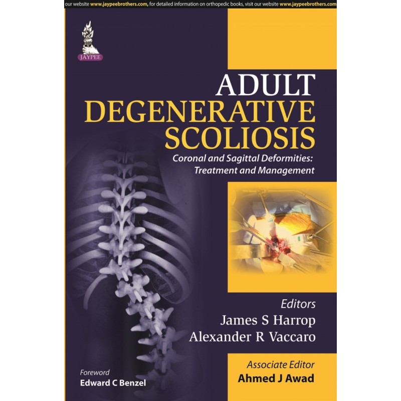 Adult Degenerative Scoliosis