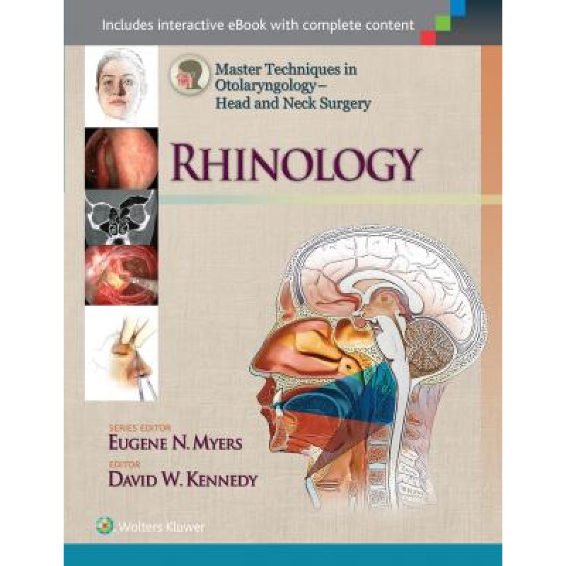 Master Techniques in Otolaryngology - Head and Neck Surgery: Rhinology