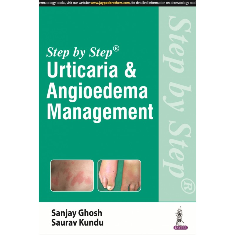 Step by Step: Urticaria  and  Angioedema Management