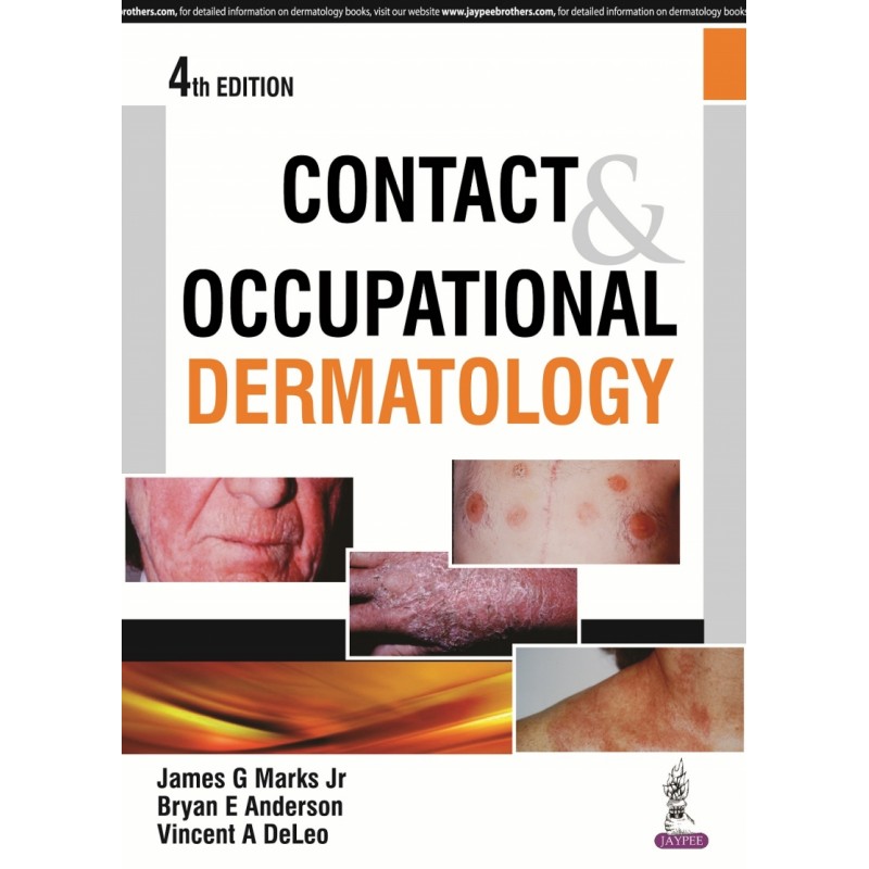 Contact  and Occupational Dermatology