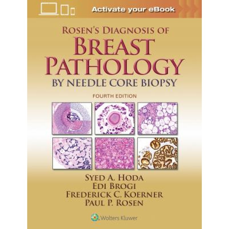 Rosen's Diagnosis of Breast Pathology by Needle Core Biopsy, 4e