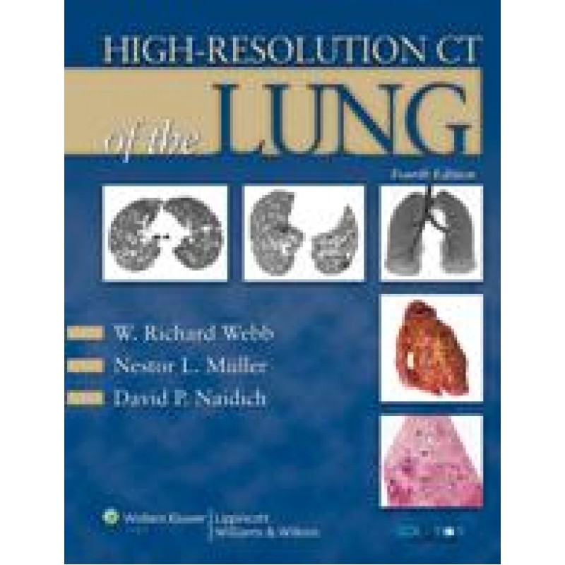 High-Resolution CT of the Lung 4/e