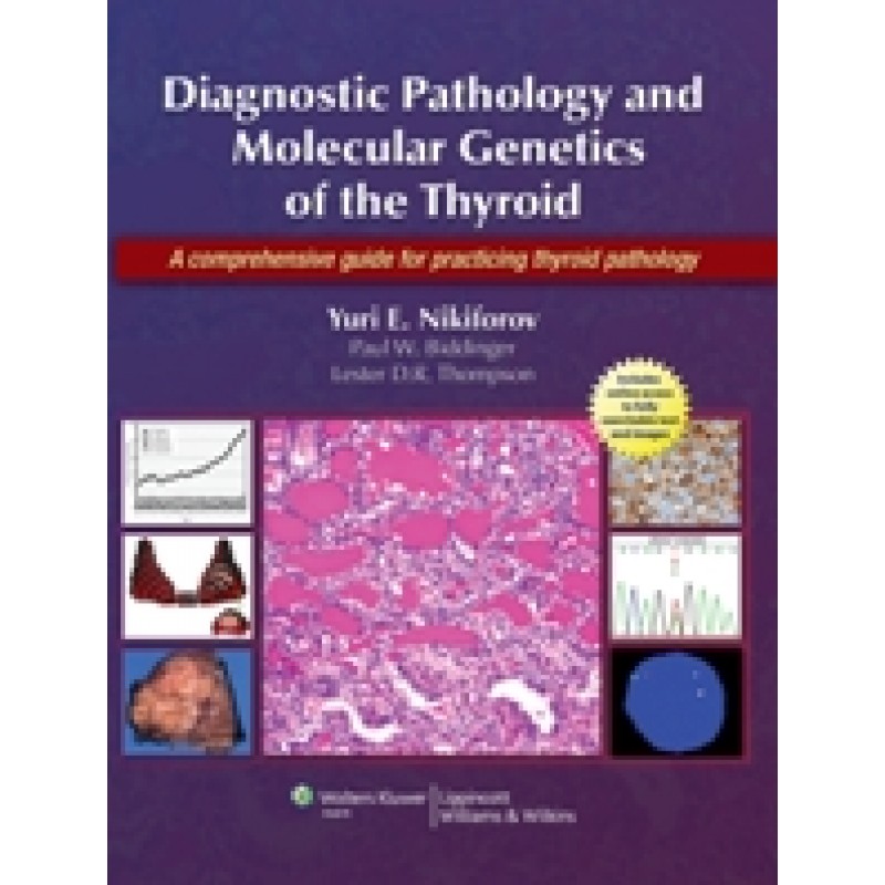 Diagnostic Surgical Pathology and Molecular Genetics of the Thyroid