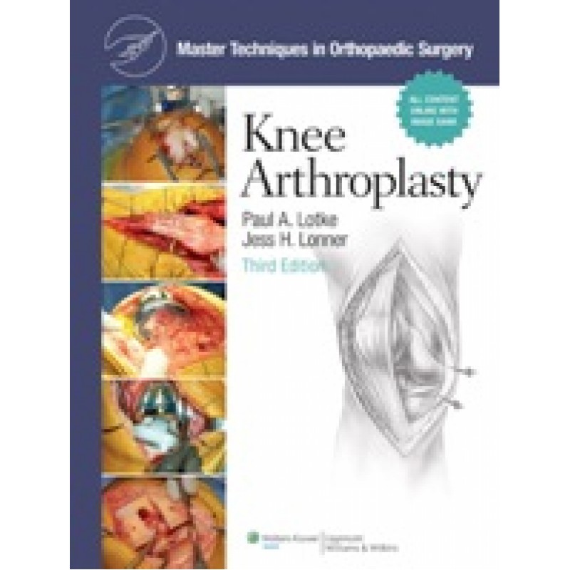 Master Techniques in Orthopaedic Surgery: Knee Arthroplasty 3/e