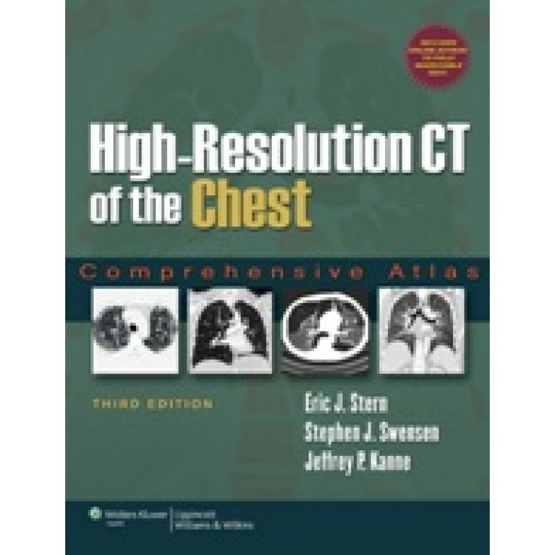 High-Resolution CT of the Chest 3/e