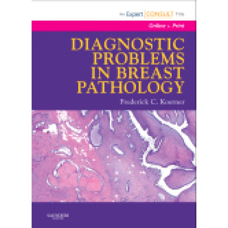 Diagnostic Problems in Breast Pathology Expert Consult: Online and Print