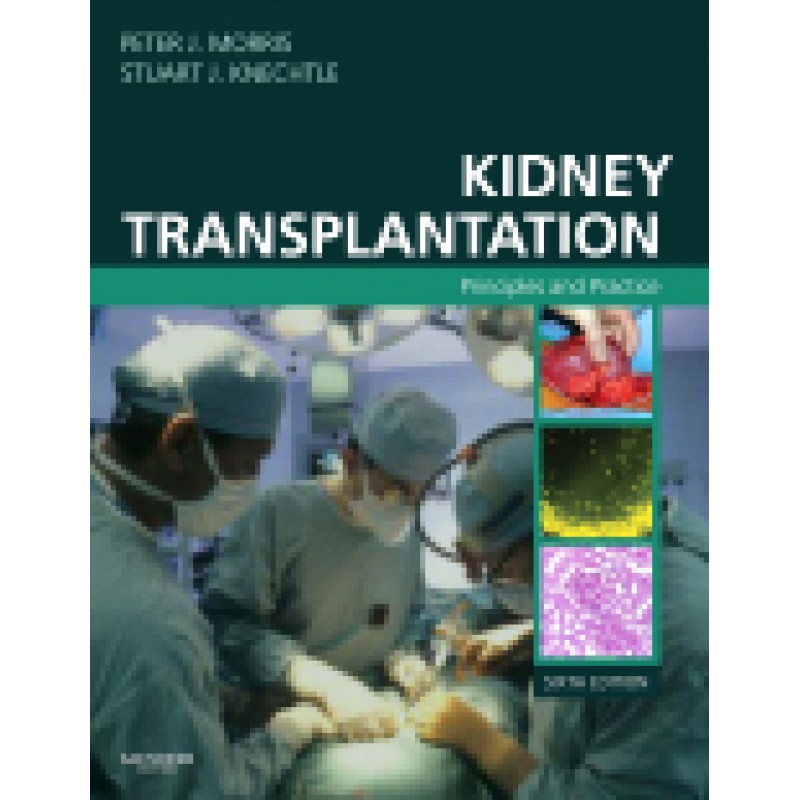 Kidney Transplantation, 6th Edition Principles and Practice