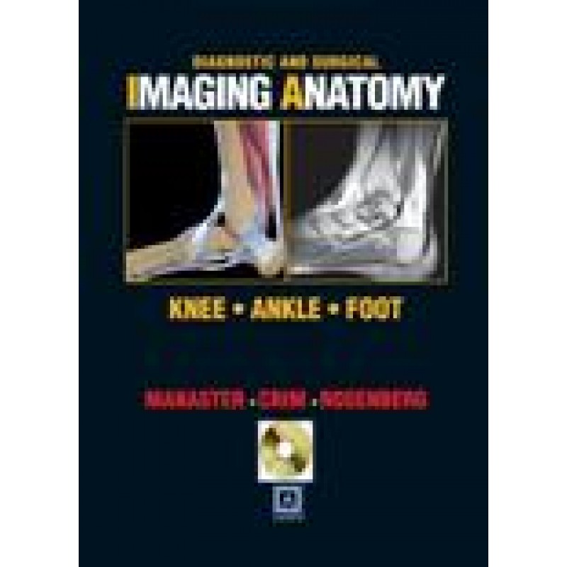 Diagnostic and Surgical Imaging Anatomy: Knee, Ankle, Foot (eBook) Package (Published by Amirsys ( 2nd Revised ISBN ))