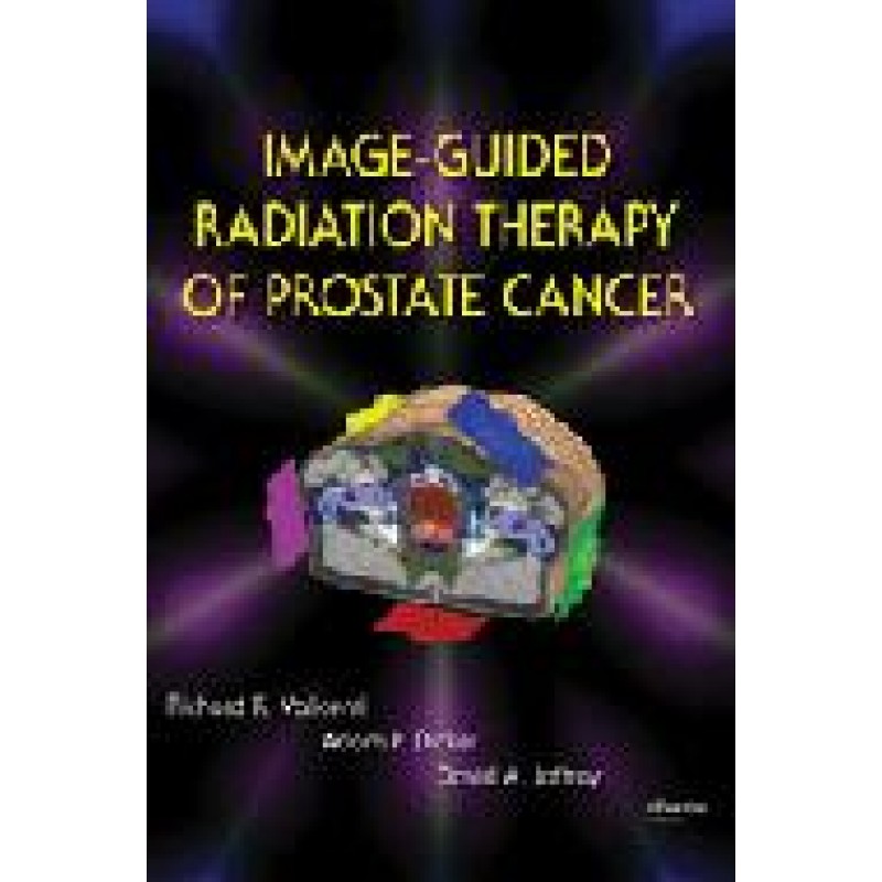 Image-Guided Radiation Therapy of Prostate Cancer