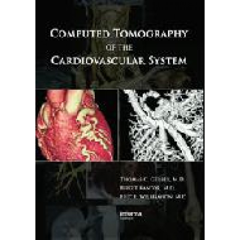 Computed Tomography of the Cardiovascular System