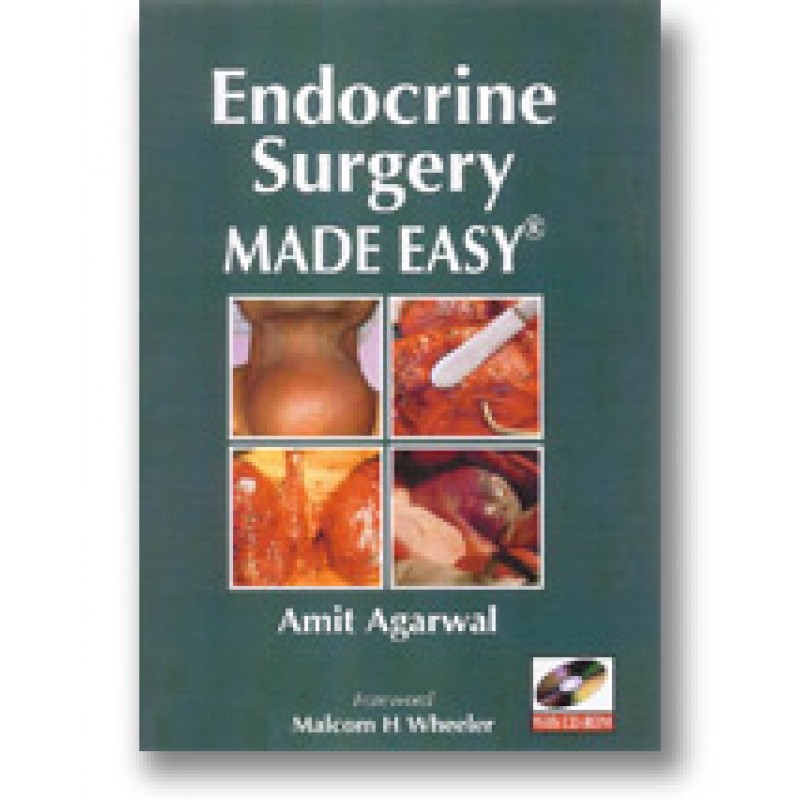 ENDOCRINE SURGERY MADE EASY