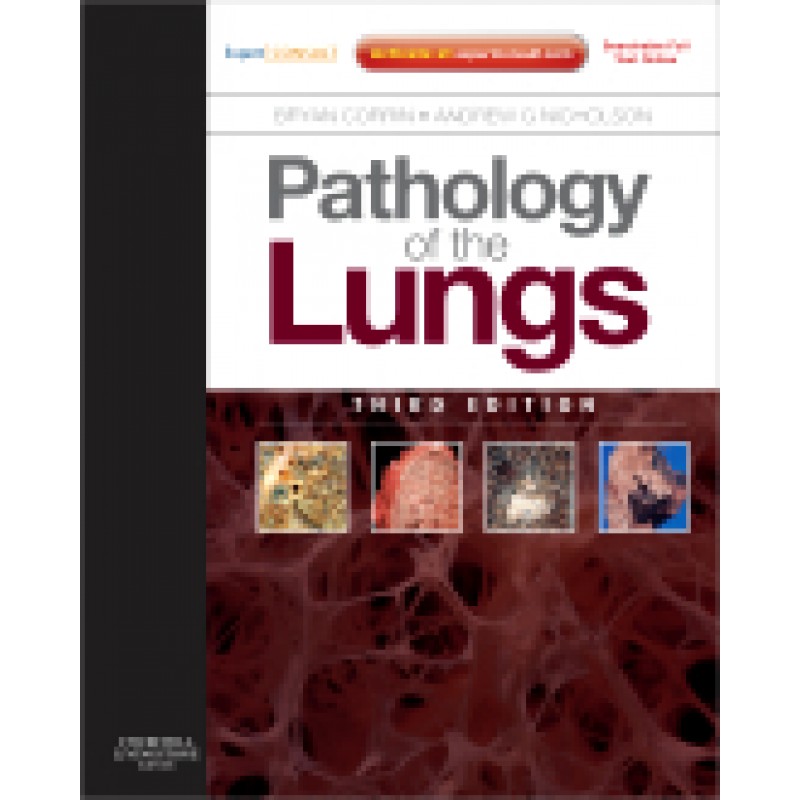 Pathology of the Lungs, 3rd Edition - Expert Consult: Online and Print