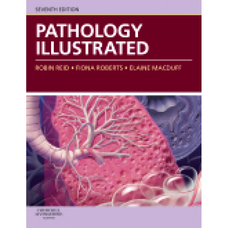 Pathology Illustrated, 7th Edition