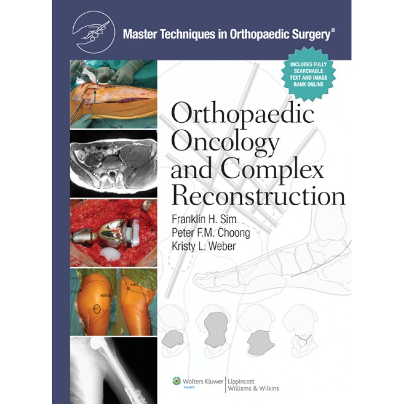 Master Techniques in Orthopaedic Surgery: Orthopaedic Oncology and Complex Reconstruction