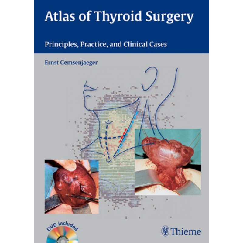 Atlas of Thyroid Surgery