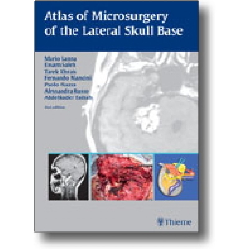 Atlas of Microsurgery of the Lateral Skull Base