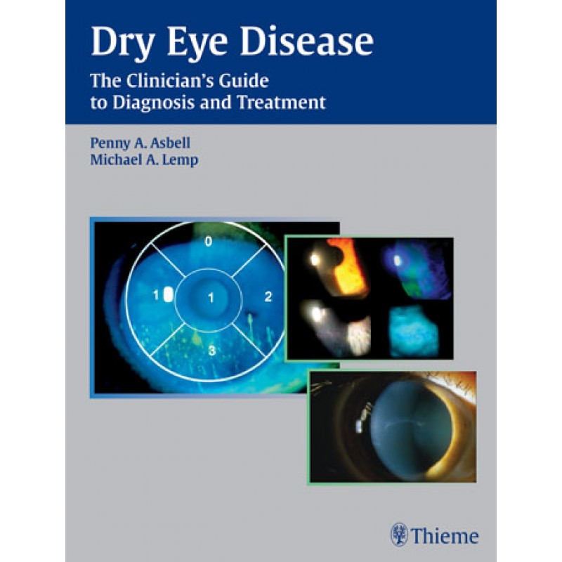 Dry Eye Disease