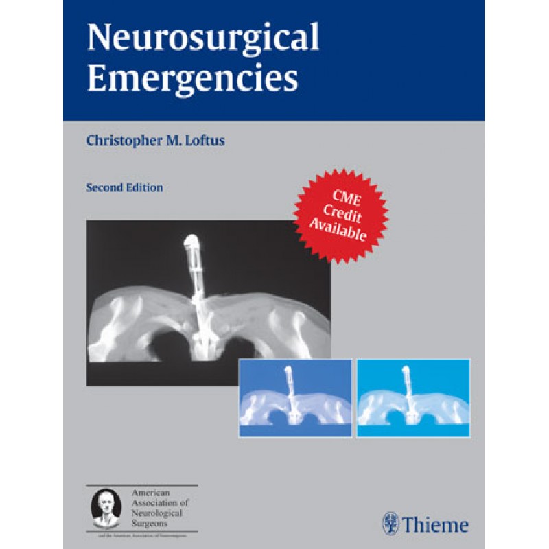 Neurosurgical Emergencies