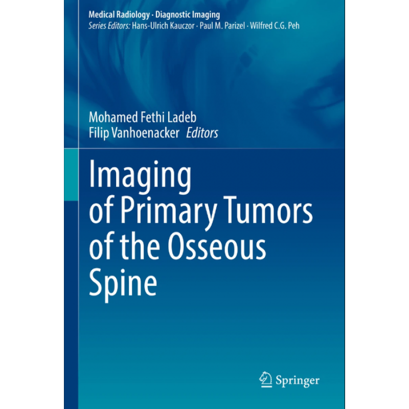 Imaging of Primary Tumors of the Osseous Spine