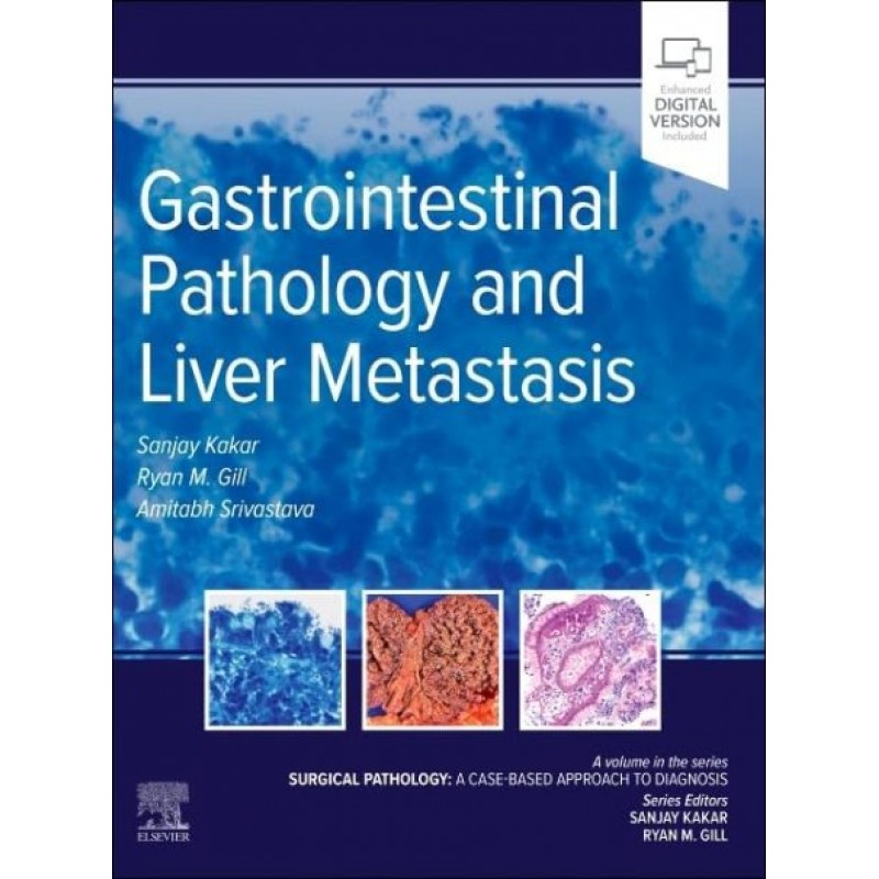 Gastrointestinal Pathology and Liver Metastasis: A Case-Based Approach to Diagnosis, 1st Edition