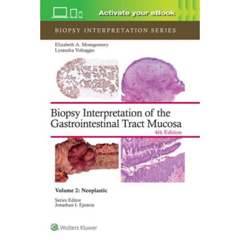 Biopsy Interpretation of the Gastrointestinal Tract Mucosa Volume 2 Neoplastic: Print + eBook with Multimedia, Fourth edition