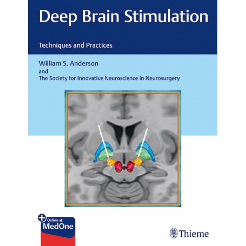  Deep Brain Stimulation Techniques and Practices