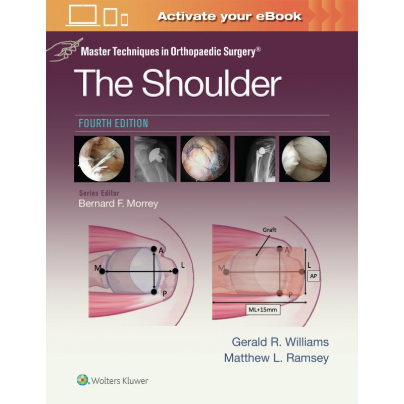 Master Techniques in Orthopaedic Surgery: The Shoulder Fourth edition