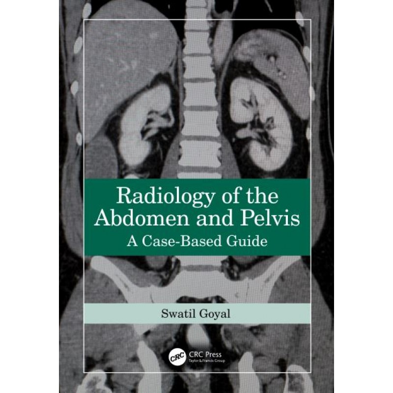 Radiology of the Abdomen and Pelvis. A Case-Based Guide