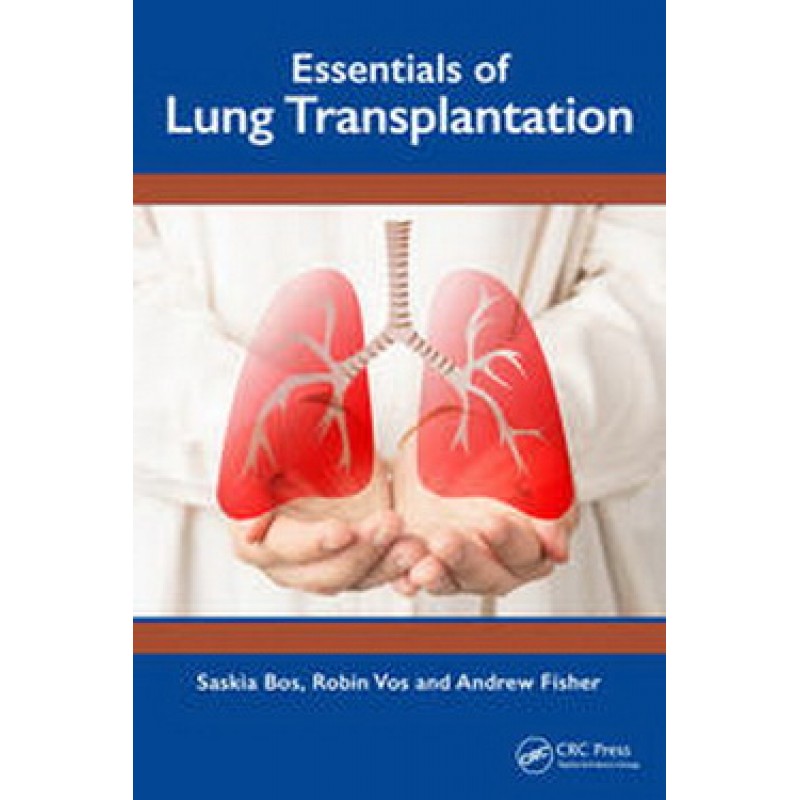 Essentials of Lung Transplantation