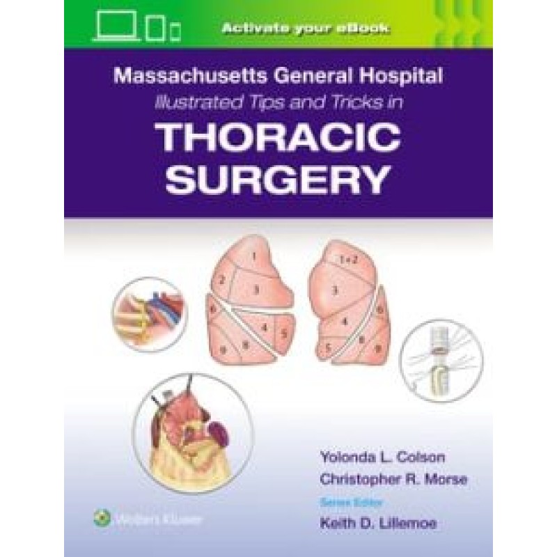 Massachusetts General Hospital Illustrated Tips and Tricks in Thoracic Surgery: Print + eBook with Multimedia First edition