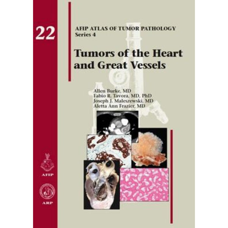 Tumors of the Heart and Great Vessels