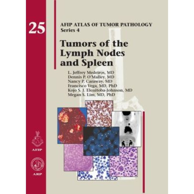 Tumors of the Lymph Nodes and Spleen