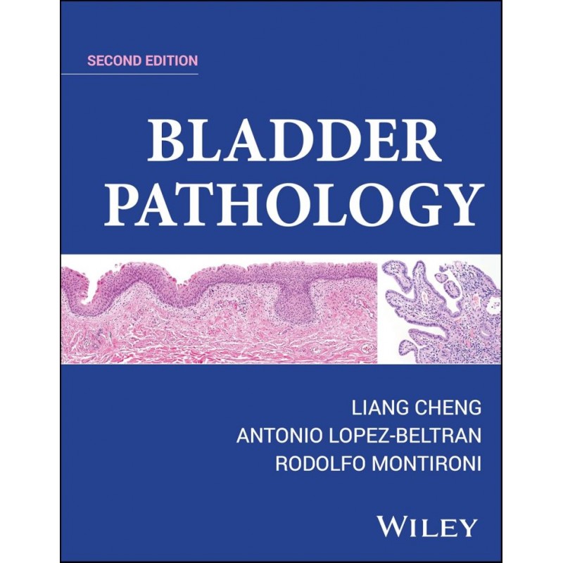 Bladder Pathology, 2nd Edition