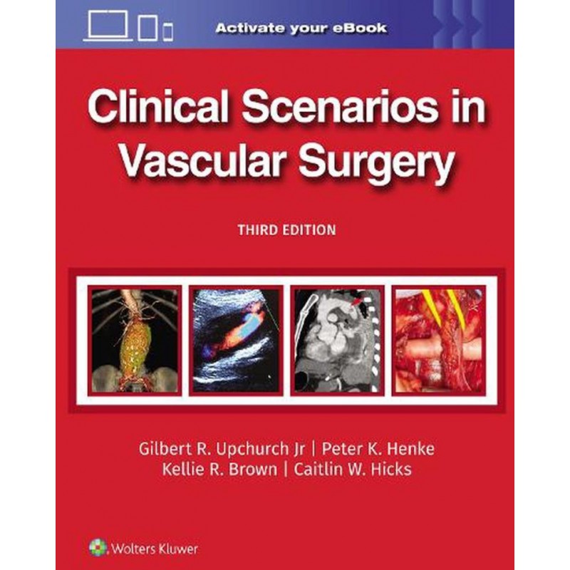 Clinical Scenarios in Vascular Surgery Third edition