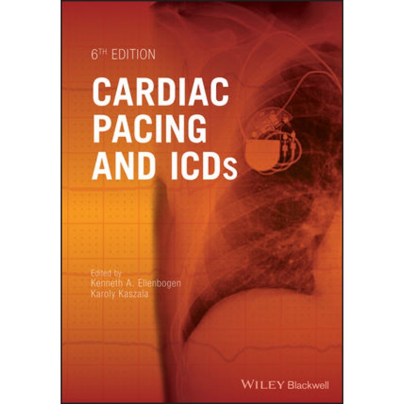 Cardiac Pacing and ICDs, 6th Edition