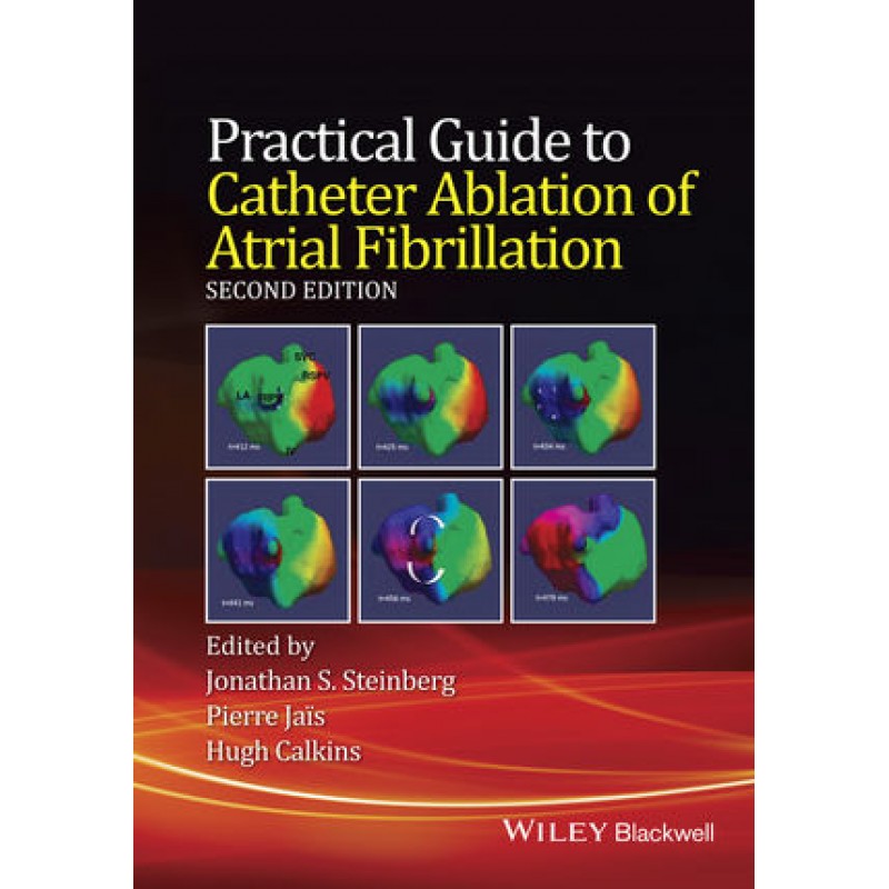 Practical Guide to Catheter Ablation of Atrial Fibrillation, 2nd Edition