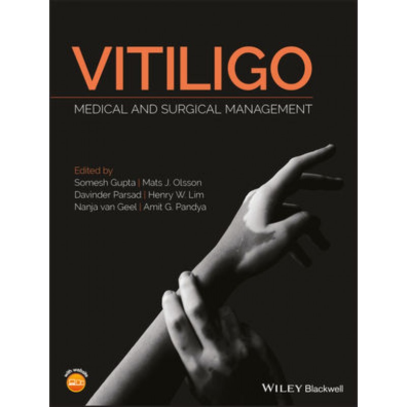 Vitiligo: Medical and Surgical Management