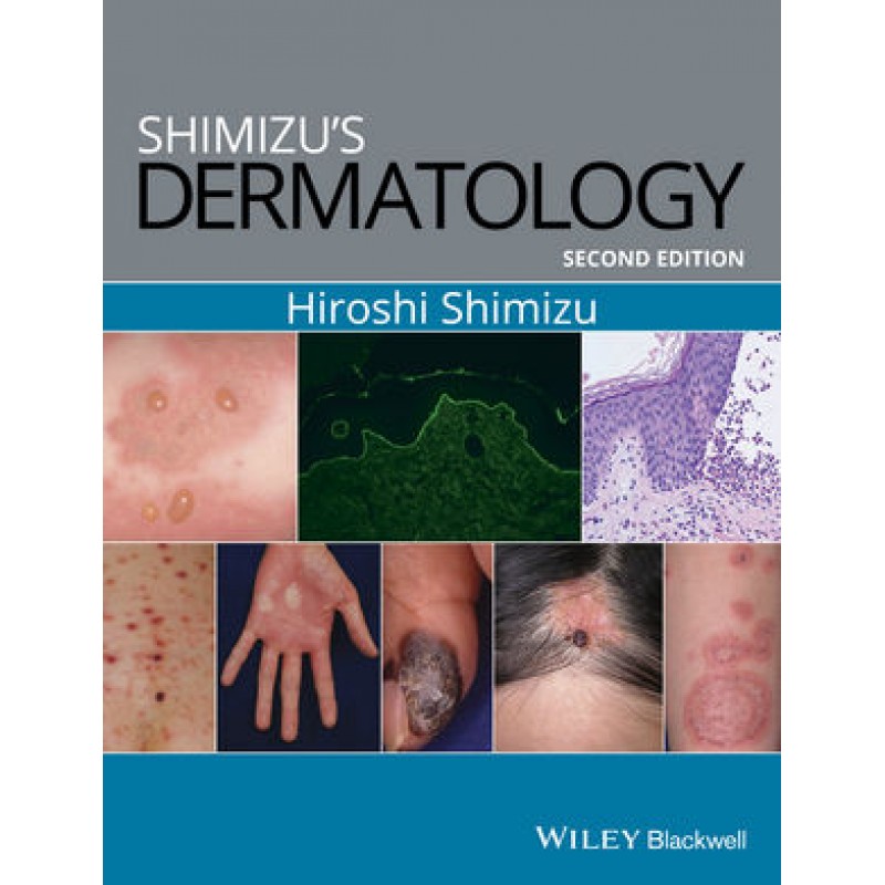 Shimizu's Dermatology, 2nd Edition