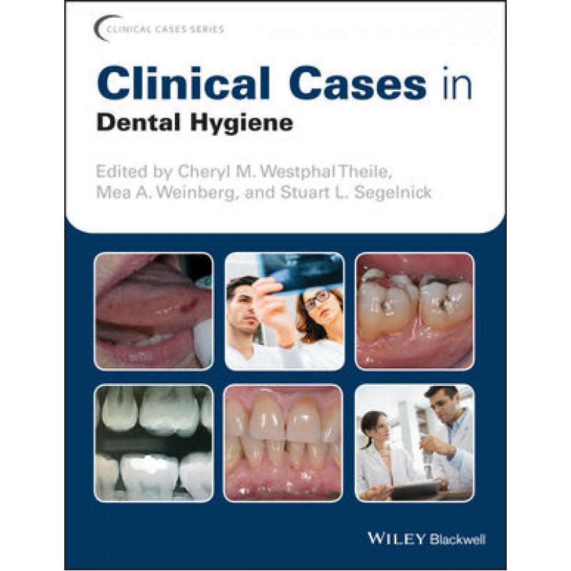 Clinical Cases in Dental Hygiene