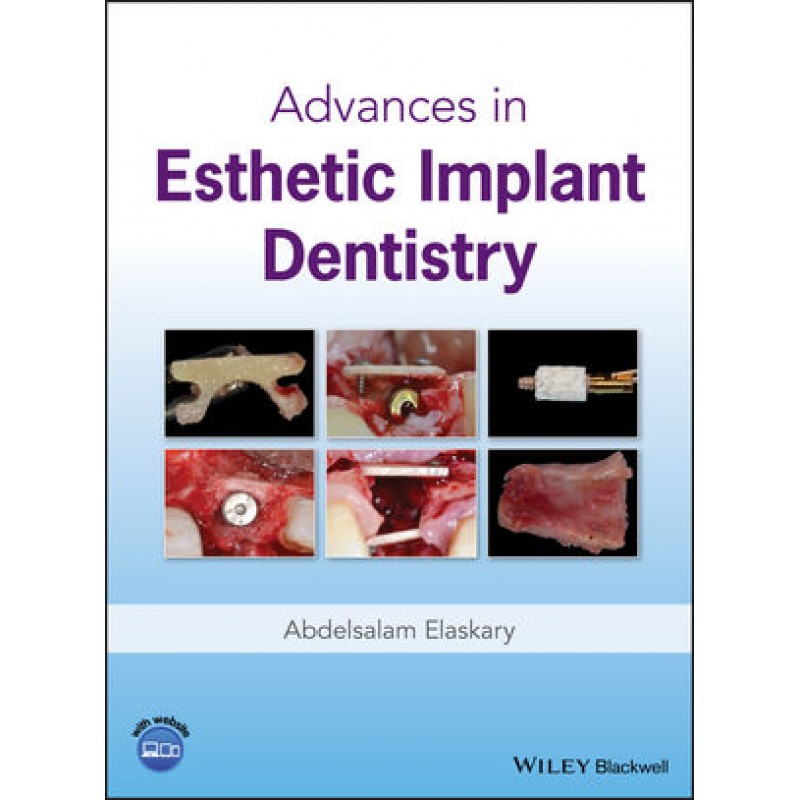 Advances in Esthetic Implant Dentistry