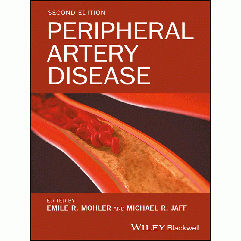 Peripheral Artery Disease, 2nd Edition